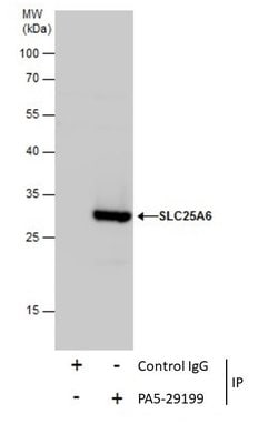 Invitrogen SLC25A6 Polyclonal Antibody 100 &mu;L; Unconjugated:Antibodies,