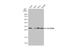 Invitrogen SLC25A6 Polyclonal Antibody 100 &mu;L; Unconjugated:Antibodies,