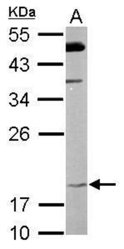 Invitrogen FAIM Polyclonal Antibody 100 &mu;L; Unconjugated:Antibodies,