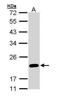 Invitrogen FAIM Polyclonal Antibody 100 &mu;L; Unconjugated:Antibodies,