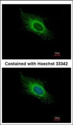 Invitrogen ATP5J Polyclonal Antibody 100 &mu;L; Unconjugated:Antibodies,