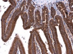 Invitrogen ATP5J Polyclonal Antibody 100 &mu;L; Unconjugated:Antibodies,