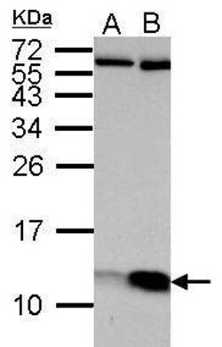 Invitrogen ATP5J Polyclonal Antibody 100 &mu;L; Unconjugated:Antibodies,