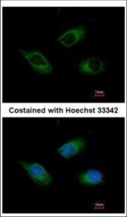 Invitrogen CIDEC Polyclonal Antibody 100 &mu;L | Buy Online | Invitrogen&trade; | Fisher Scientific