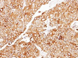 Invitrogen CIDEC Polyclonal Antibody 100 &mu;L | Buy Online | Invitrogen&trade; | Fisher Scientific