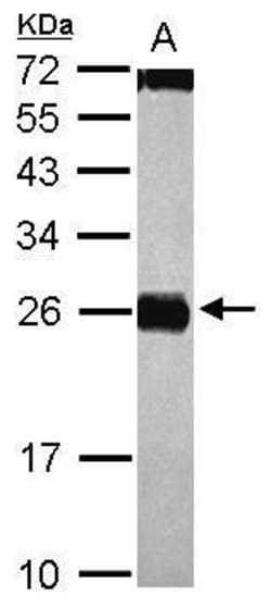 Invitrogen CIDEC Polyclonal Antibody 100 &mu;L | Buy Online | Invitrogen&trade; | Fisher Scientific