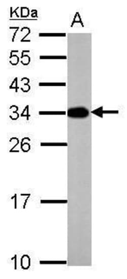 Invitrogen V-ATPase E2 Polyclonal Antibody 100 &mu;L; Unconjugated:Antibodies,