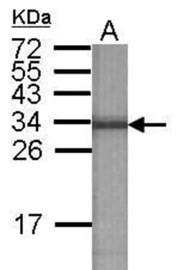 Invitrogen V-ATPase E2 Polyclonal Antibody 100 &mu;L; Unconjugated:Antibodies,