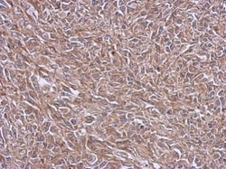 Invitrogen NDUFB4 Polyclonal Antibody 100 &mu;L; Unconjugated:Anticuerpos