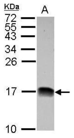 Invitrogen NDUFB4 Polyclonal Antibody 100 &mu;L; Unconjugated:Anticuerpos
