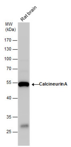 Invitrogen Calcineurin A Polyclonal Antibody 100 &mu;L; Unconjugated:Antibodies,
