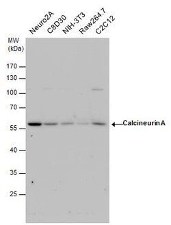 Invitrogen Calcineurin A Polyclonal Antibody 100 &mu;L; Unconjugated:Antibodies,