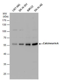 Invitrogen Calcineurin A Polyclonal Antibody 100 &mu;L; Unconjugated:Antibodies,