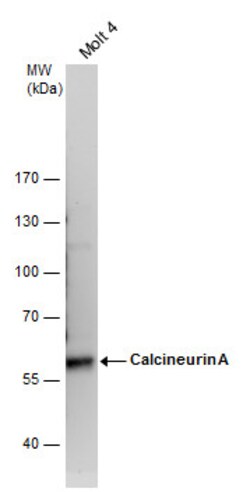 Invitrogen Calcineurin A Polyclonal Antibody 100 &mu;L; Unconjugated:Antibodies,