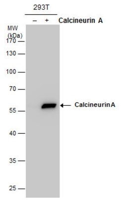 Invitrogen Calcineurin A Polyclonal Antibody 100 &mu;L; Unconjugated:Antibodies,
