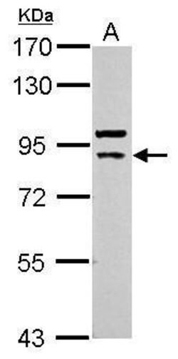 Cullin 5 Polyclonal Antibody, Invitrogen 100 &mu;L; Unconjugated:Antibodies,