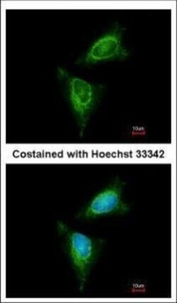 Invitrogen RSK1 Polyclonal Antibody 100 &mu;L | Buy Online | Invitrogen&trade; | Fisher Scientific