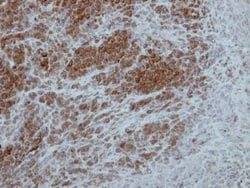 Invitrogen RSK1 Polyclonal Antibody 100 &mu;L | Buy Online | Invitrogen&trade; | Fisher Scientific