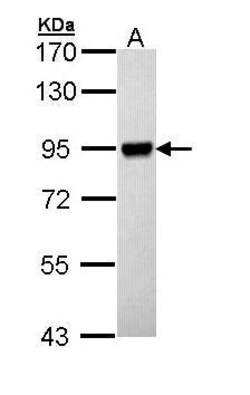 Invitrogen RSK1 Polyclonal Antibody 100 &mu;L | Buy Online | Invitrogen&trade; | Fisher Scientific