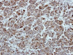 TID1 Polyclonal Antibody, Invitrogen 100 &mu;L; Unconjugated:Antibodies,