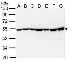 TID1 Polyclonal Antibody, Invitrogen 100 &mu;L; Unconjugated:Antibodies,