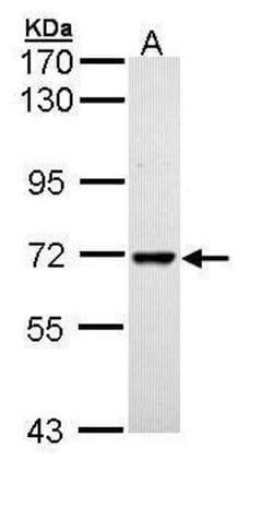 Invitrogen PPIL2 Isoform B Polyclonal Antibody 100 μL; Unconjugated:Antibodies,