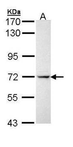 Invitrogen IL1R1 Polyclonal Antibody 100 &mu;L; Unconjugated:Antibodies,