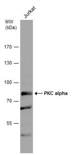Invitrogen PKC alpha Polyclonal Antibody 100 &mu;L; Unconjugated:Antibodies,