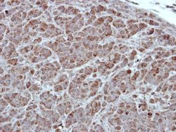 Invitrogen PKC alpha Polyclonal Antibody 100 &mu;L; Unconjugated:Antibodies,