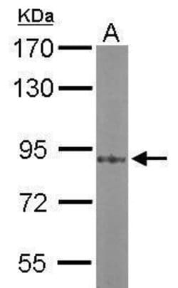Invitrogen PKC alpha Polyclonal Antibody 100 &mu;L; Unconjugated:Antibodies,
