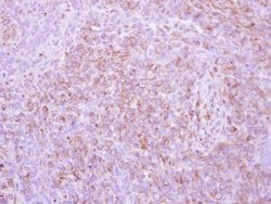 Invitrogen pro-EGF Polyclonal Antibody 100 &mu;L; Unconjugated:Antibodies,