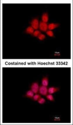 Invitrogen NCK1 Polyclonal Antibody 100 &mu;L | Buy Online | Invitrogen&trade; | Fisher Scientific