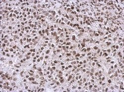 Invitrogen NCK1 Polyclonal Antibody 100 &mu;L | Buy Online | Invitrogen&trade; | Fisher Scientific