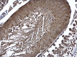 Invitrogen Cyclin B2 Polyclonal Antibody 100 μL; Unconjugated:Antibodies,