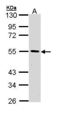 Invitrogen HIPPI Polyclonal Antibody 100 &mu;L; Unconjugated:Antibodies,