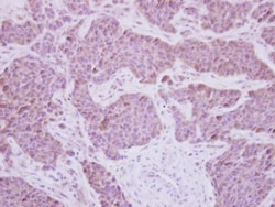 Invitrogen MEK5 Polyclonal Antibody 100 &mu;L; Unconjugated:Antibodies,