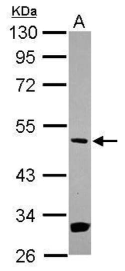 Invitrogen MEK5 Polyclonal Antibody 100 &mu;L; Unconjugated:Antibodies,