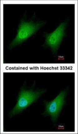 Invitrogen SMAD2 Polyclonal Antibody 100 &mu;L | Buy Online | Invitrogen&trade; | Fisher Scientific