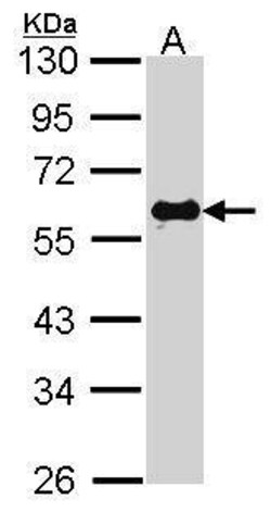 Invitrogen SMAD2 Polyclonal Antibody 100 &mu;L | Buy Online | Invitrogen&trade; | Fisher Scientific