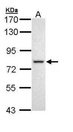 Invitrogen DDX41 Polyclonal Antibody 100 &mu;L; Unconjugated:Antibodies,