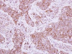 Invitrogen EEF1D Polyclonal Antibody 100 μL; Unconjugated:Antibodies,