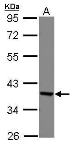 Invitrogen EEF1D Polyclonal Antibody 100 μL; Unconjugated:Antibodies,