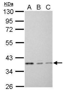 Invitrogen EEF1D Polyclonal Antibody 100 μL; Unconjugated:Antibodies,