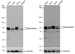 Invitrogen DVL2 Polyclonal Antibody 100 &mu;L; Unconjugated:Antibodies,
