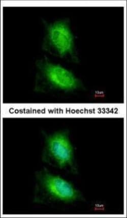 Invitrogen JIP2 Polyclonal Antibody 100 &mu;L; Unconjugated:Antibodies,