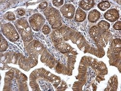 Invitrogen alpha Catenin Polyclonal Antibody 100 &mu;L; Unconjugated:Antibodies,