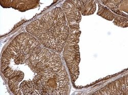 Invitrogen alpha Catenin Polyclonal Antibody 100 &mu;L; Unconjugated:Antibodies,
