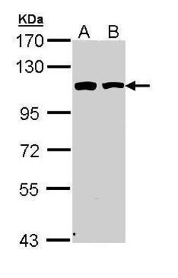 Invitrogen alpha Catenin Polyclonal Antibody 100 &mu;L; Unconjugated:Antibodies,