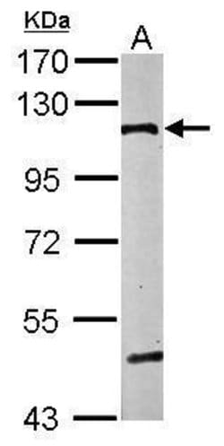 Invitrogen alpha Catenin Polyclonal Antibody 100 &mu;L; Unconjugated:Antibodies,