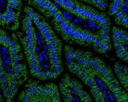 Invitrogen alpha Catenin Polyclonal Antibody 100 &mu;L; Unconjugated:Antibodies,